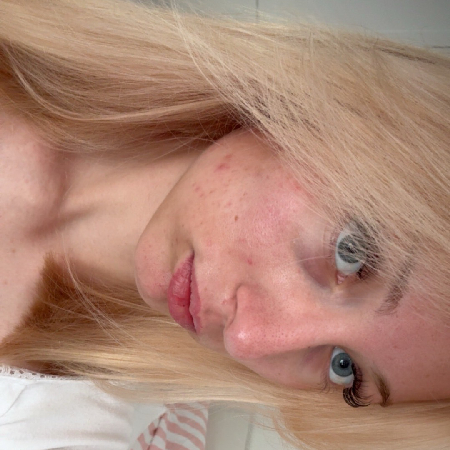 Annalein